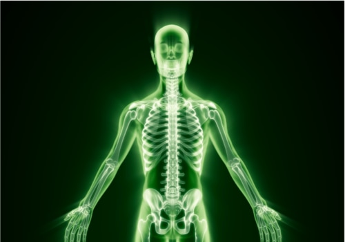 Calculating Personal Injury Claims in the UK